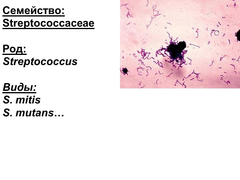 Семейство: Streptococcaceae  Род:  Streptococcus  Виды: S. mitis S. mutans…